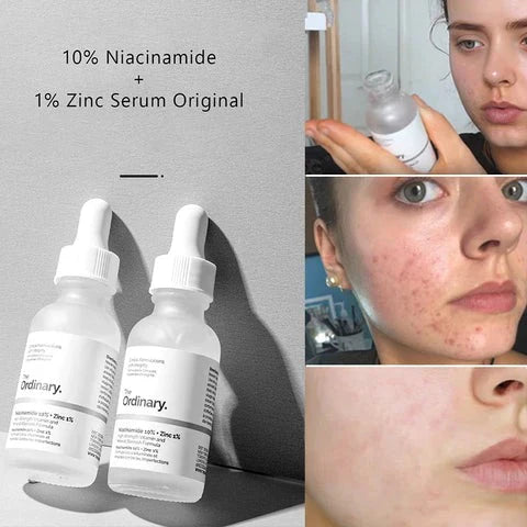 The Ordinary Niacinamide 10% + Zinc 1% ( with batch code )