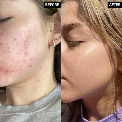 The Ordinary Niacinamide 10% + Zinc 1% ( with batch code )